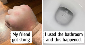 17 People Who Cope With Their Unlucky Situations by Sharing Them