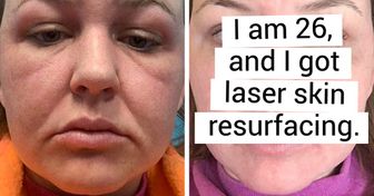 16 People Who Dared to Go for a Big Change and Now Can’t Take Their Eyes Off the Mirror