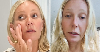 “One Eye Was Higher Than the Other,” Gwyneth Paltrow, 51, Opens Up About “Unsuccessful” Botox Injection