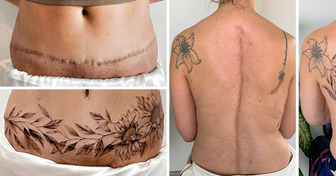 An Artist Transforms Scars Into a Blossoming Symbol of Beauty