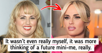 10 Celebrities Who Opened Up About Their Struggles With Pregnancy