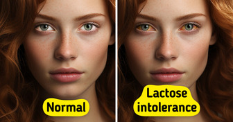 10 Signs Your Body Struggles With Lactose Intolerance