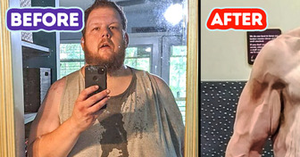 Man Flooded With Praise After He Boasted With a Stunning 336lb Weight Loss