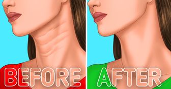 6 Tips to Make Your Neck Lines Go Away