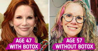 The “Little House on the Prairie” Star Melissa Gilbert, Said NO to Botox and Decided to Age Naturally