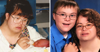 A Woman With Down Syndrome Gives Birth to a Boy With the Same Condition and Raises Him as a Single Mom