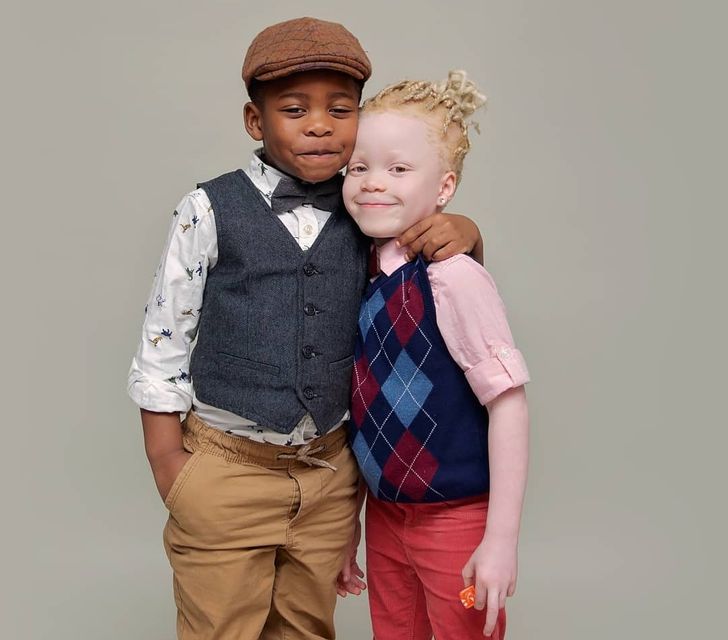 Twins With Different Skin Colors Astonished Their Mom When They Were Born