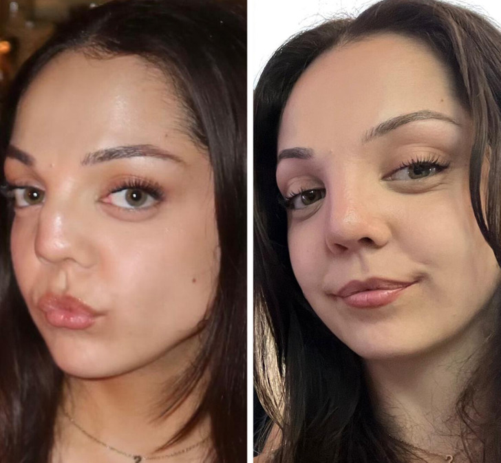 8d723259a2af1a95c54f655372 13 Before-and-After Photos That Tell a Whole Story / Bright Side