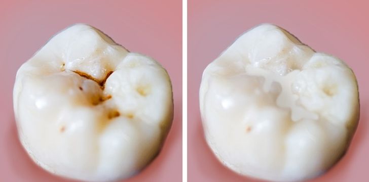 8 Major Mistakes We Make When Taking Care of Our Teeth