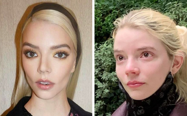 15+ Celebrities Who Flaunt Their Beauty Without a Drop of Makeup