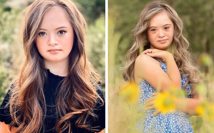 A Girl With Down Syndrome Beats Doctor’s Odds and Grows Into a Stunningly Beautiful Model