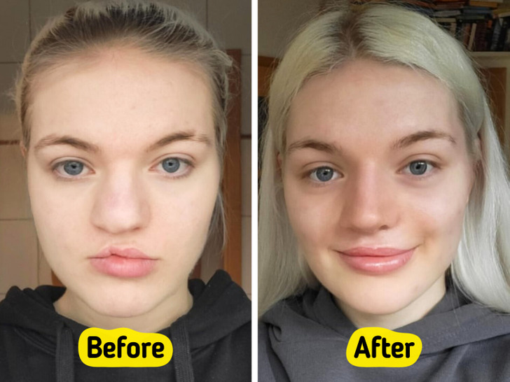 0ed09858408495de9a4a0c1b5f 13 Before-and-After Photos That Tell a Whole Story / Bright Side