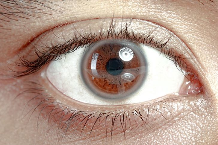 12 Things Your Eyes Can Tell About Your Health