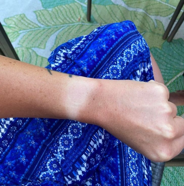 20 Pics of People Who Took Tanning Too Far and Were “Truly Marked”