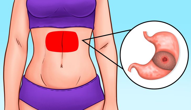 types-of-abdominal-pain-or-stomach-ache-based-on-organ-systems