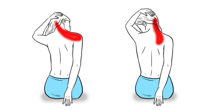 Levator Scapulae Stretch