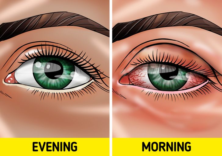 7 Things That Can Happen to You If You Sleep With Makeup On