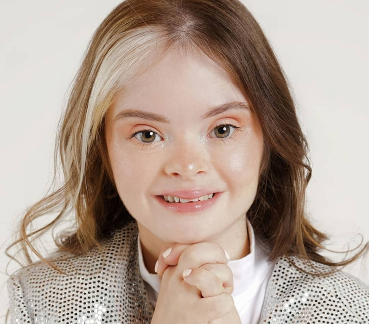 Jessica, a Model With Down Syndrome, Proves That Only You Can Define What Beauty Is