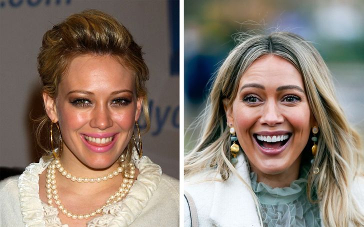 How the Smiles of 15 Celebrities Changed After They Fixed Their Teeth