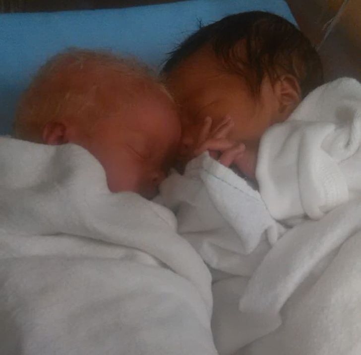 Twins With Different Skin Colors Astonished Their Mom When They Were Born