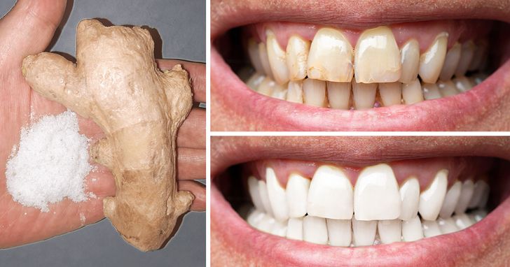 8 Natural Ways to Make Your Teeth Whiter at Home