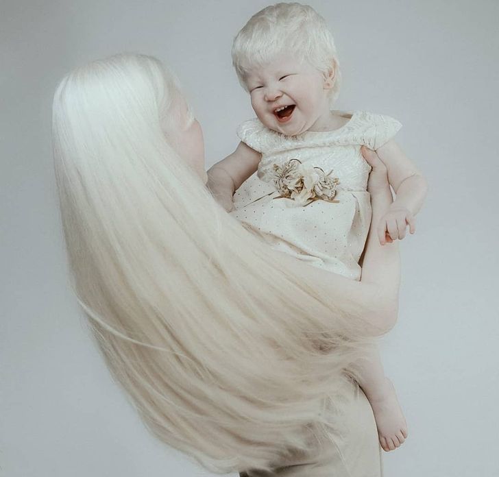 Albino Sisters Born 12 Years Apart Excite the Internet With Their Photos