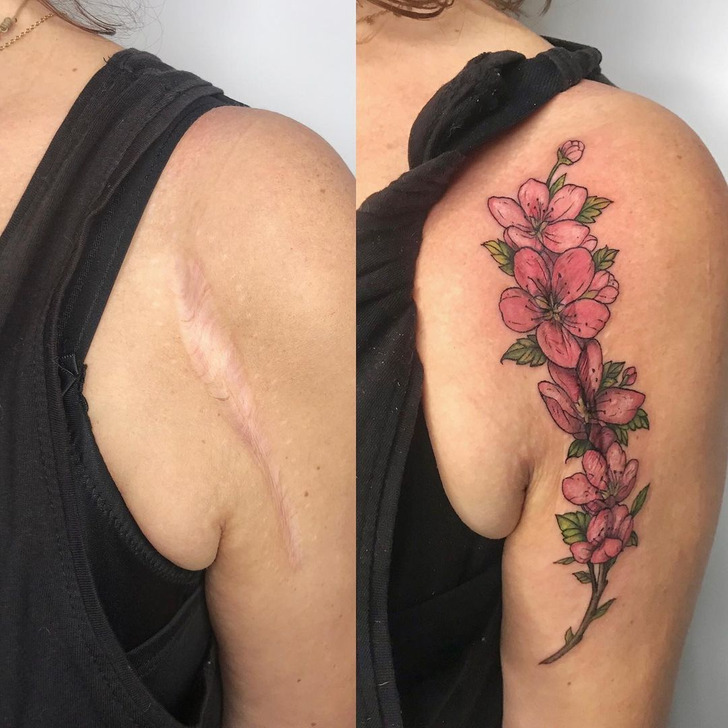 14 Times People Covered Up Their Scars With Glorious Tattoos / Bright Side