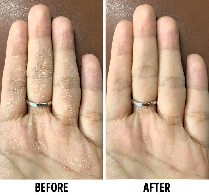 5 Ways to Make Your Dry Hands Softer, Straight From Derms