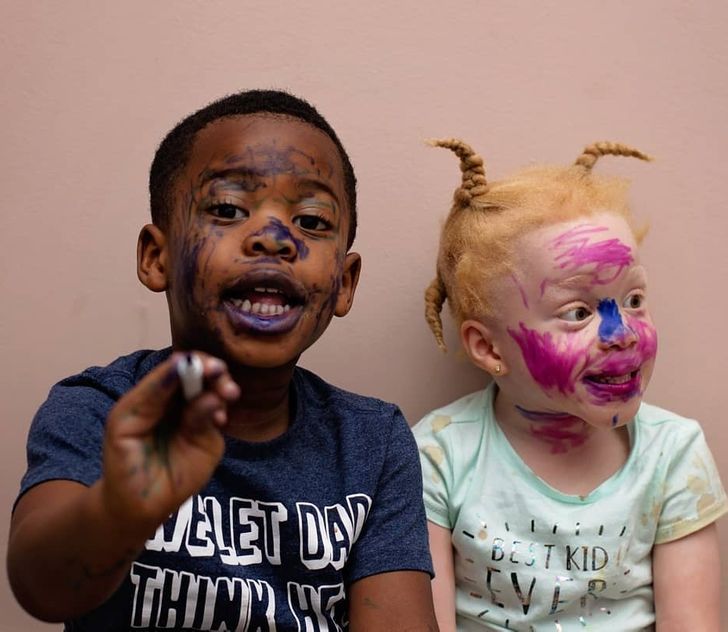 Twins With Different Skin Colors Astonished Their Mom When They Were Born