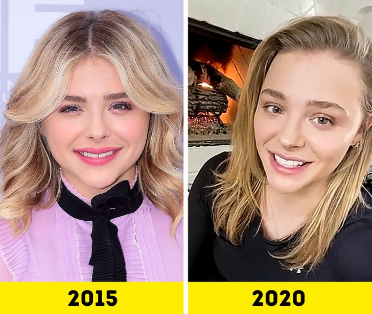 20 Celebrities That Changed So Much in 5 Years, You Won’t Be Able to Recognize Them