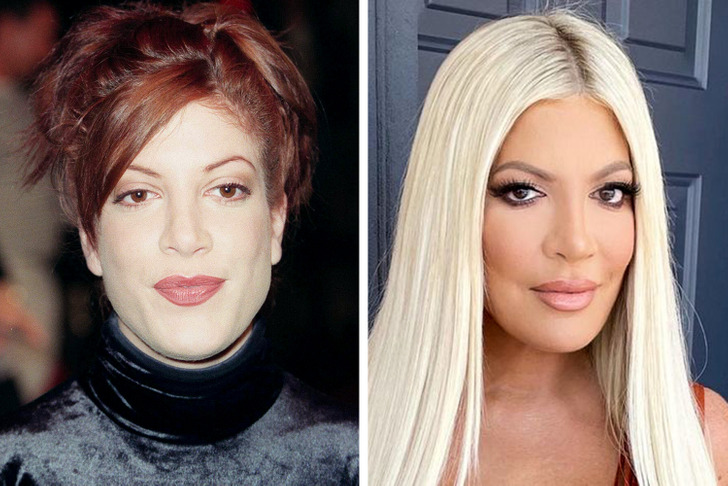 Celebrities Who Regret Plastic Surgery: Cosmetic Botches