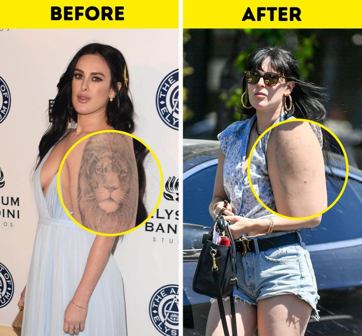 10+ Celebrities Who Decided to Get Rid of Their Tattoos (Some of Them Are Really Embarrassed) / Bright Side
