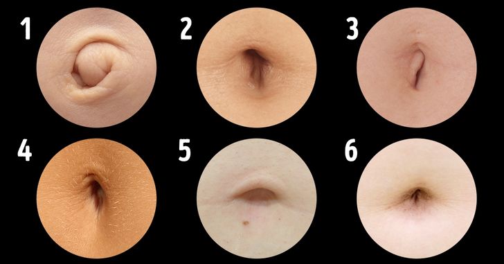 types of belly buttons