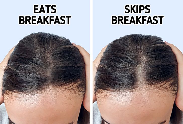 10 Daily Habits That Are Causing Your Hair to Thin