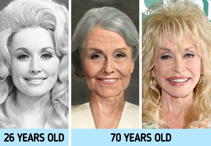 Dolly Parton Shares Regrets About Getting Plastic Surgery