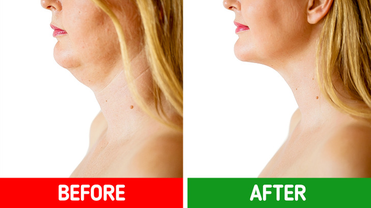 Exercises to tighten discount chin and neck