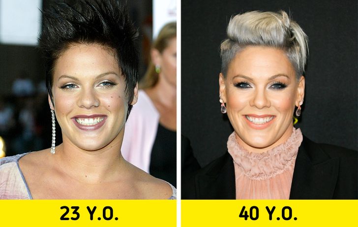 11 Celebrities Who Shunned Cosmetic Surgery and Embraced Their Natural Look