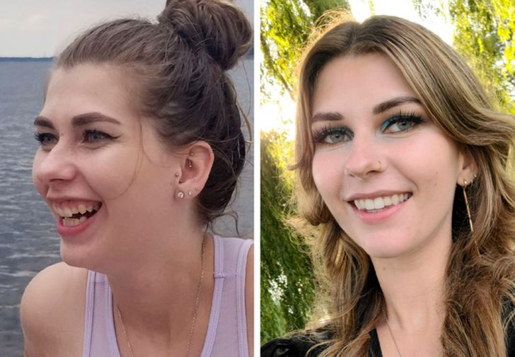18 People Who Dared to Get Plastic Surgery and Hit the Jackpot