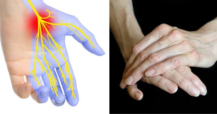 7 Things Your Hands Can Tell About Your Health