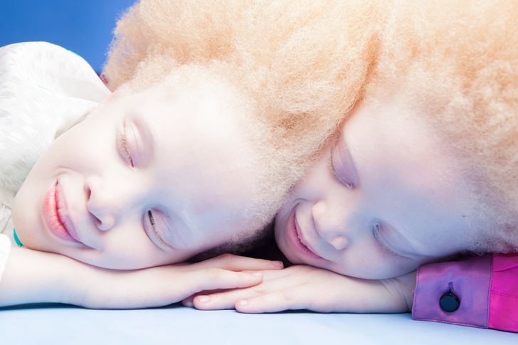 The Utterly Unique Appearance of These Twins Has Stunned the Internet