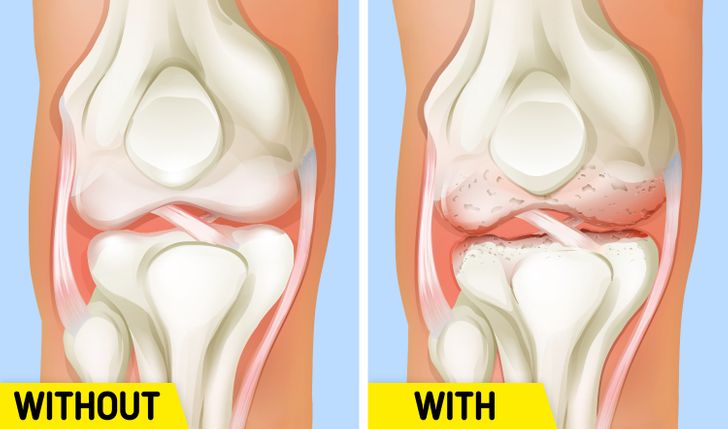 12 Healthy Habits That Can Come Back to Bite You If You Overdo Them