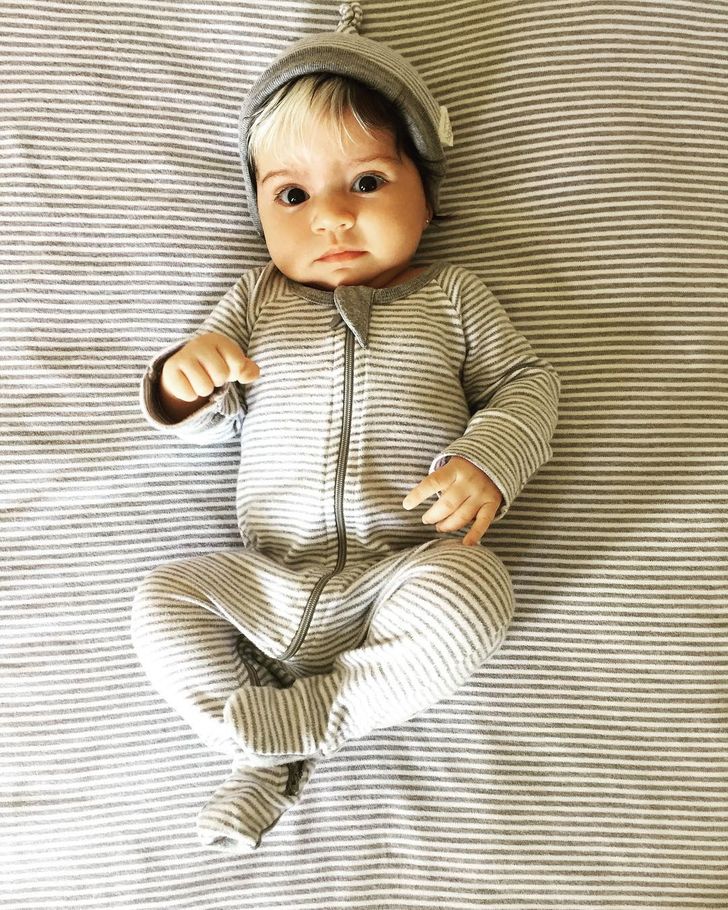 This Baby Girl Who Was Born With Gray Hair Is Proof That Our Flaws Make Us More Beautiful