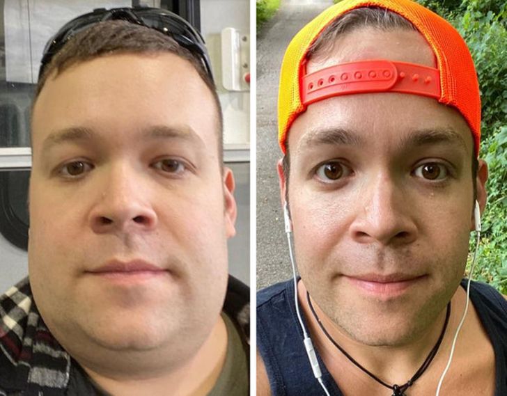 20 Pounds Weight Loss Face 