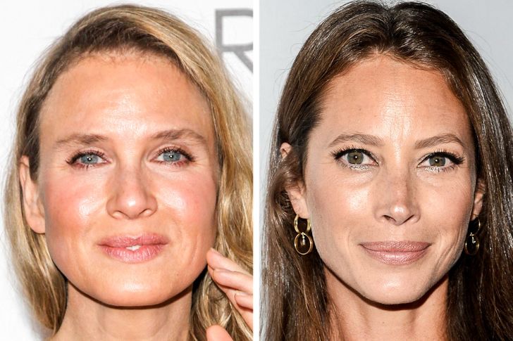 uma thurman plastic surgery 2022