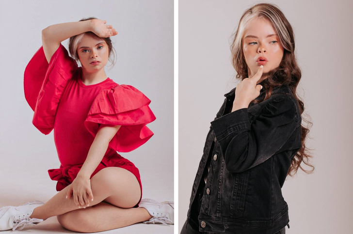 Jessica, a Model With Down Syndrome, Proves That Only You Can Define What Beauty Is