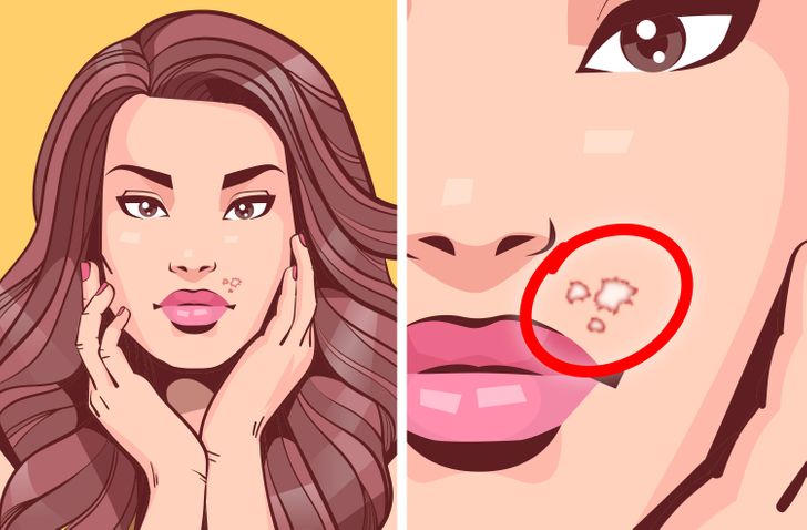 6 Unobvious Things That Can Happen if You Bite Your Nails