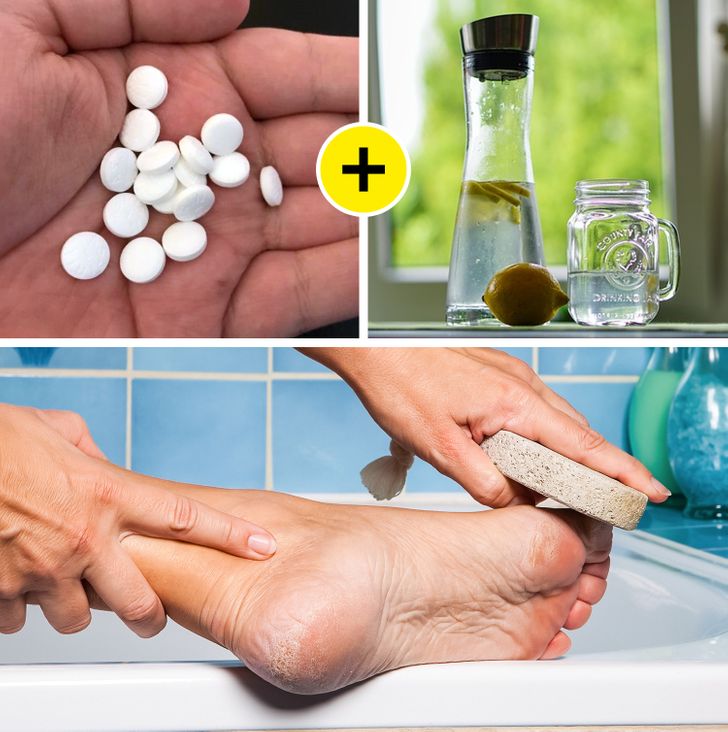 10 Fast Ways to Get Rid of Calluses and Get Baby Soft Feet