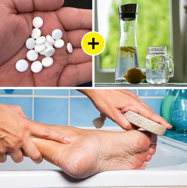 5 Quick Ways to Remove Hard Foot Skin, Corns and Calluses