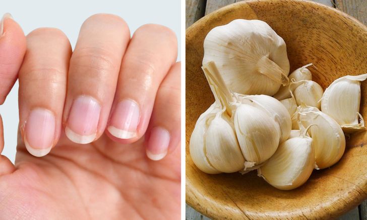 10 Home Remedies That Can Do Wonders for Your Nails