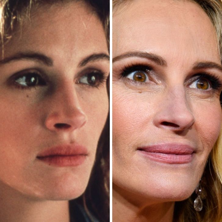 24 Close-Up Comparisons That Show How Our Favorite Celebrities Have Changed
